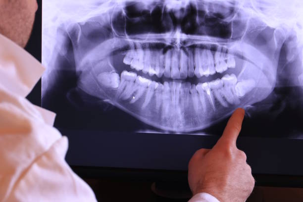 Best Cracked Tooth Emergency Dentist  in Whitesboro, NY